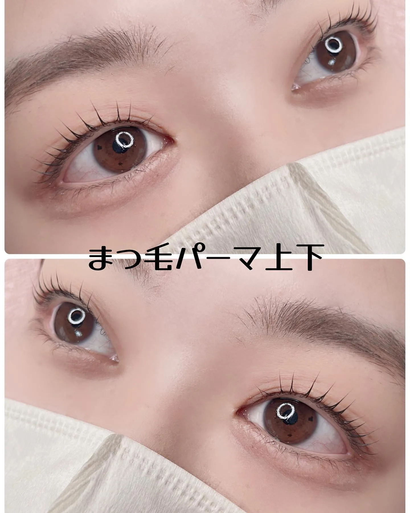 逆まつげがお悩み
